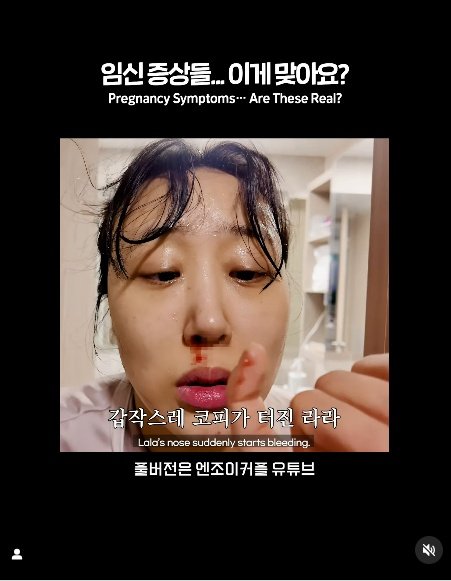 &apos;손민수♥&apos; 임라라 갑자기 코피 나…임신 증상 이거 맞아요?[스타이슈]