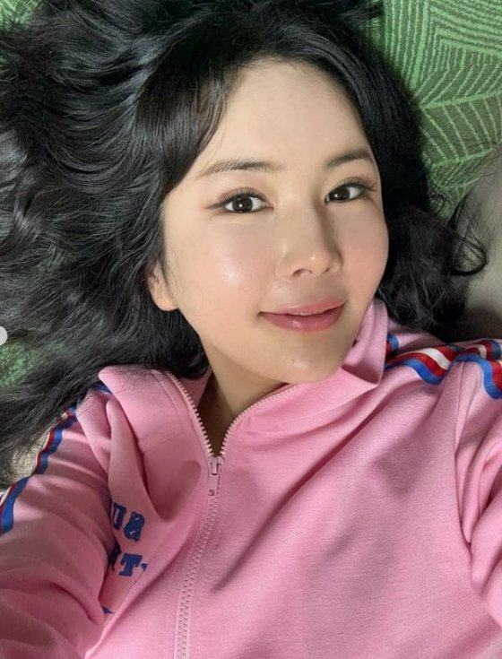 장영란, 안면거상 효과 제대로…성형해서 얼굴 변했네 악플 받을 만했던 이유는?