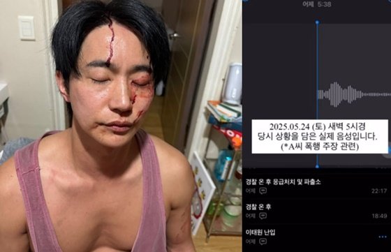 &apos;前여친 폭행+성병 부인&apos; 전호준, 피투성이 얼굴→녹취록 공개…때리지 마 비명 [종합]