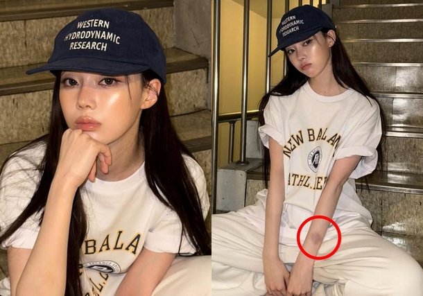 에스파 윈터, 컴백 앞두고 피멍 포착…팬들 걱정 [RE:스타]
