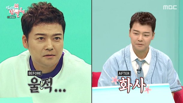 전현무, 눈 밑 지방 재배치 고백…만족도 높아, 다크서클 없어져 (전참시)