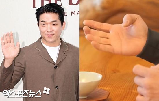 안성재 손가락 절단 사고 흔적 관련 이미지