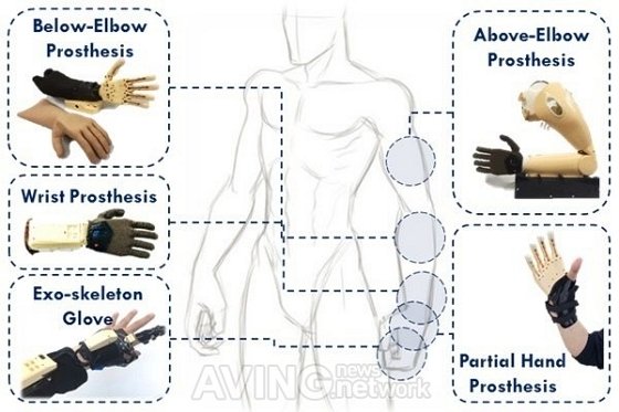 [CES 2021 GCA] 만드로(Mand.ro), 비용 걱정 덜어주는 Mandro Prosthetic Hands(의수) 알린다 ...