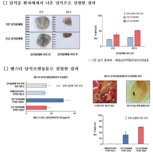 '담석증' 담낭 제거하지 않고 담석만 골라 녹인다…담석 용해제 개발 : 네이트 뉴스