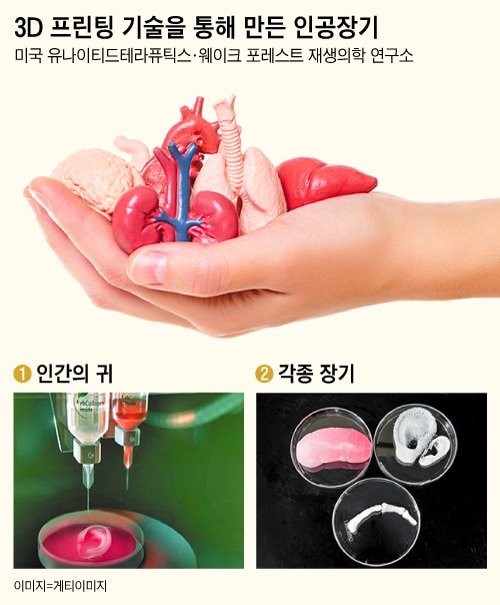 늘어난 수명에 장기 부족 극심…인공장기 기술, 곧 38조원 산업된다 : 네이트 뉴스