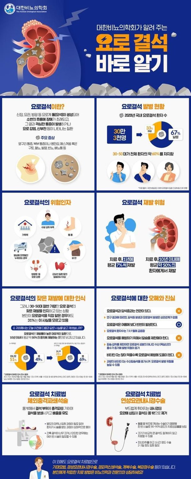 맥주 마시면 몸속 돌이 배출된다고? 오히려 요로결석 위험 높여 : 네이트 뉴스