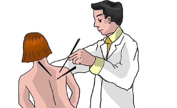 한의사 행세한 목사, 무면허로 침 놓다 환자 숨지게 해…집행유예 : 네이트 뉴스