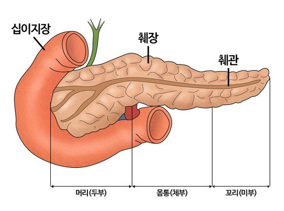 생존율 제일 낮은 췌장암…이 증상 땐 발병위험 16배 높다 : 네이트 뉴스