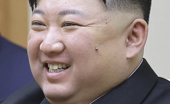 김정은 볼에 '대왕 뾰루지'…4년전부터 계속 크는데 왜 그냥 두나 : 네이트 뉴스