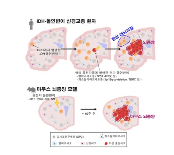 뇌종양, 어디서 시작되나 했더니…정상 뇌 속 세포였다 : 네이트 뉴스