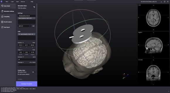 뉴로핏, 'NEUROPHET TMS LAB' 뇌영상치료계획SW 인증 : 네이트 뉴스