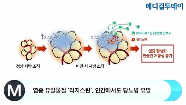 염증 유발물질 '리지스틴', 인간에서도 당뇨병 유발 : 네이트 뉴스