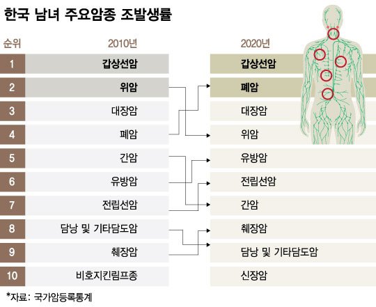 [더차트] 위암보다 '이 암' 더 걸렸다…10년 새 발병률 급증 : 네이트 뉴스