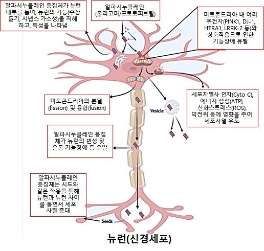 KBSI, 파킨슨병 발병 기전 및 치료제 연구 결과 집대성 : 네이트 뉴스