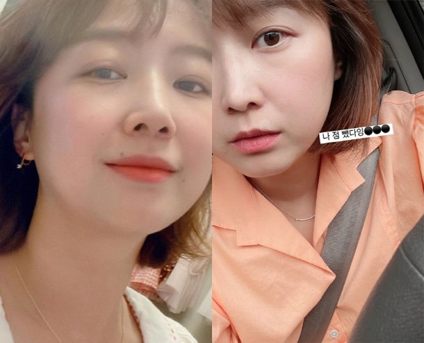 '정형돈♥' 한유라, 입술 위 매력점 빼고 미모 얻었네…점 하나로 확 달라진 얼굴 : 네이트 연예