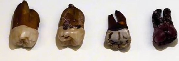 커피·차·콜라·와인에 넣은 치아 색깔 '충격' 결과 : 네이트 뉴스