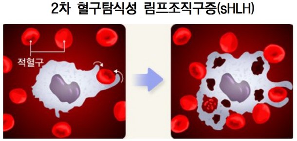 젊은층도 안심 못해…'사이토카인' 새 뇌관 : 네이트 뉴스