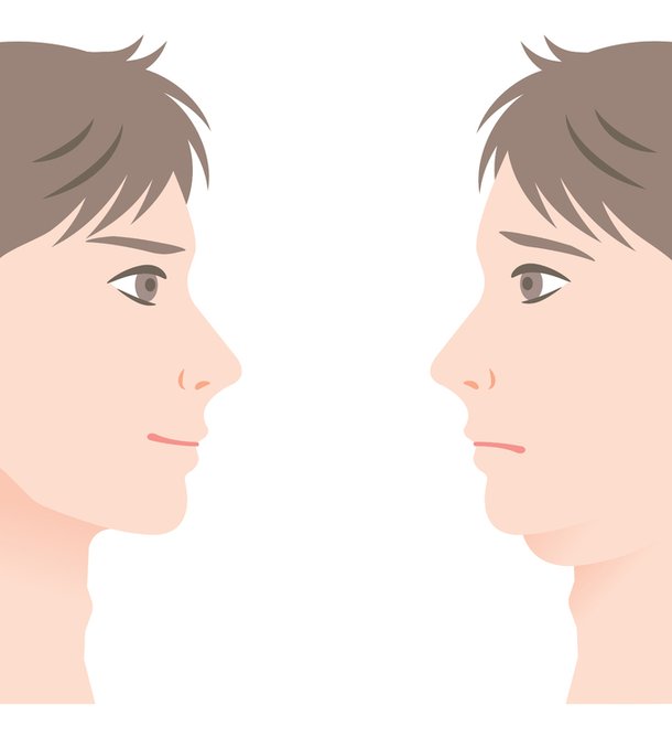 다이어터의 영원한 고민…턱살 어떻게 빼야 하나 : 네이트 뉴스