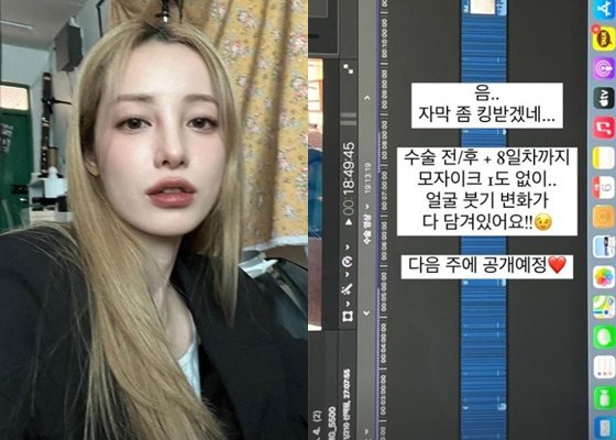 유깻잎, 얼굴 성형 후 근황…모자이크 없이 공개 예고 : 네이트 연예