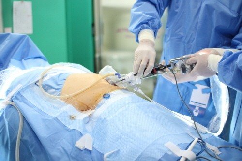 입원 기간 단축하는 맹장(충수염) 수술, 담소유외과 '단일통로복강경' : 네이트 뉴스