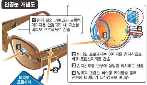 600만弗 사나이처럼 `생체공학 눈` 얻었죠 : 네이트 뉴스