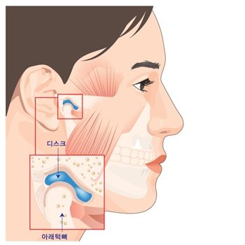 턱 모양 이상하다면 건강상태부터 살펴야 : 네이트 뉴스
