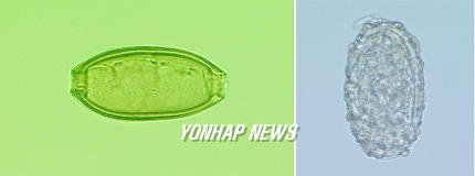 400년전 미라의 편충과 회충 : 네이트 뉴스